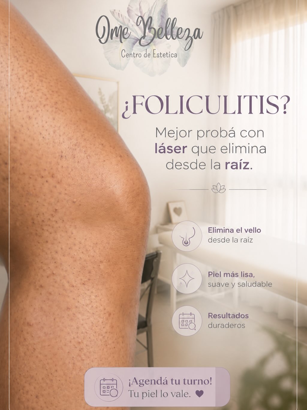 Placa de Ome Belleza: «¿Foliculitis? Mejor probá con láser que elimina desde la raíz»